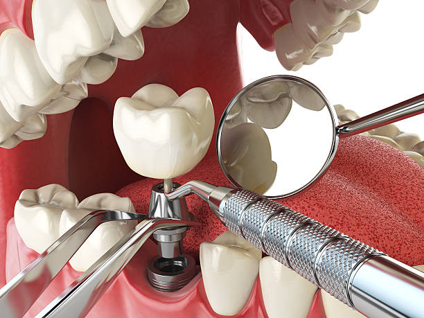 Best Emergency Broken Tooth Repair in Doney Park, AZ